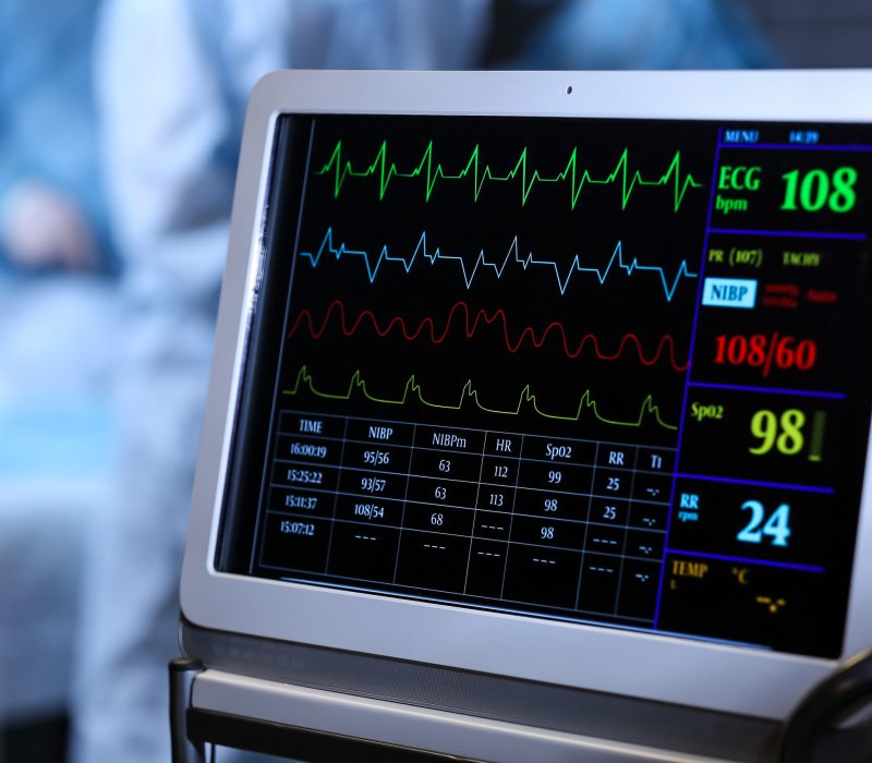 Modern heart rate monitor in operating room