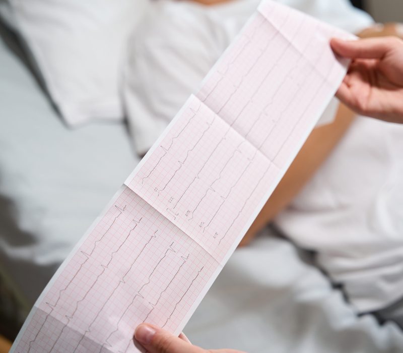 Partial image of female nurse checking electrocardiogram of pregnant woman